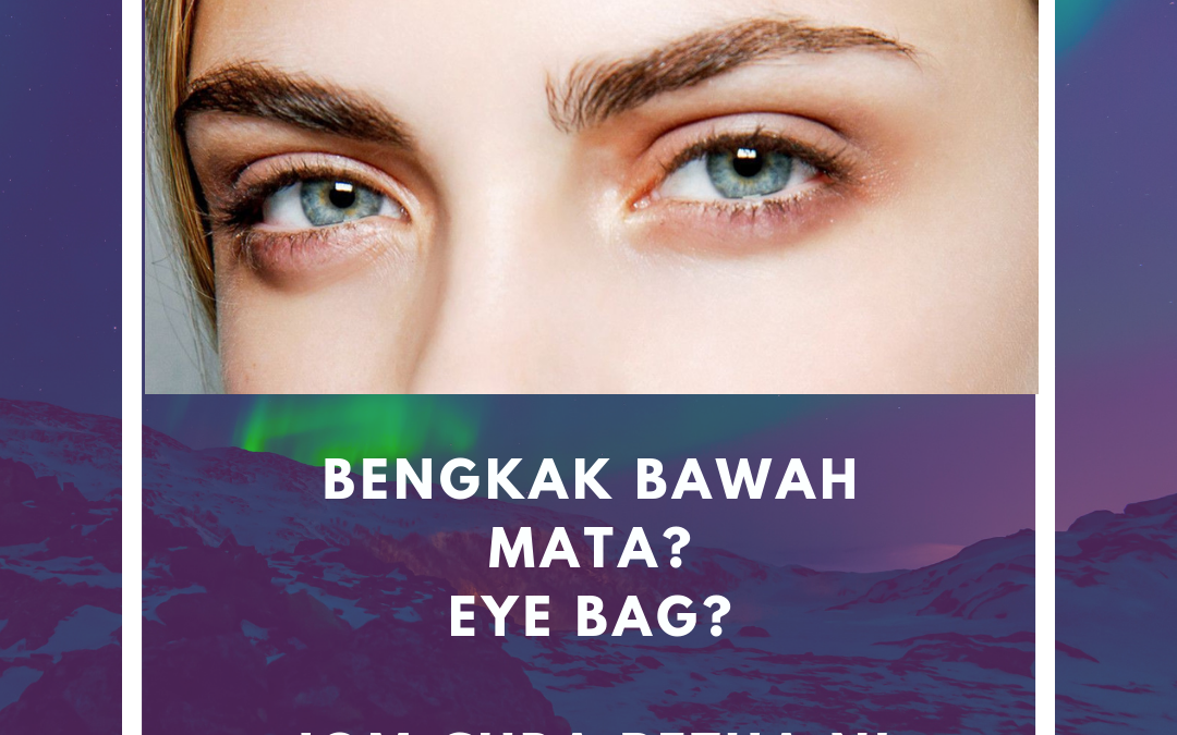 Cara Hilangkan Eye Bag