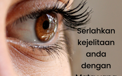 Petua Hilangkan Hitam Bawah Mata