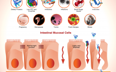 Simptom Leaky Gut (Perut Bocor)